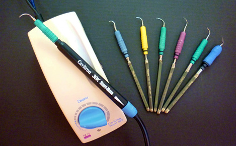 スケーリングで歯石の除去